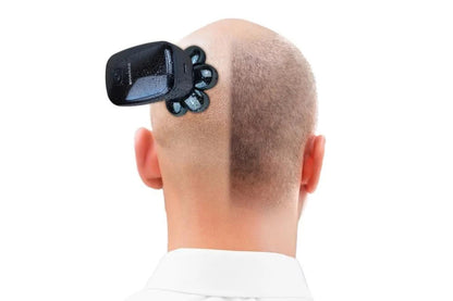 Bald Pro Precision Baldness Trimmer for a Clean & Confident Look ✨💇‍♂️